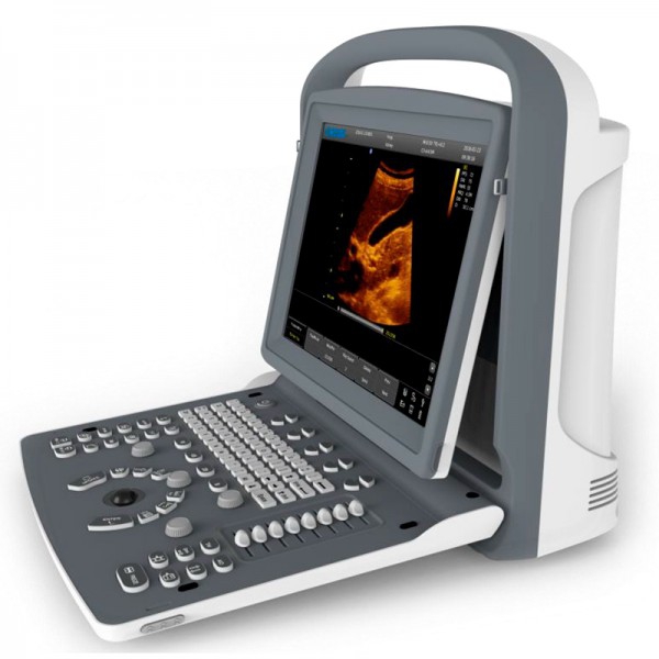 Macchina per ultrasuoni portatile Chison ECO2