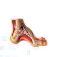 Esposizione del piede cavo