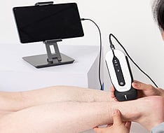 Macchine ad ultrasuoni Chison Sonoeye