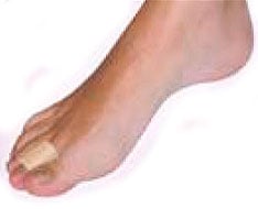 Protezioni e modelli di silicone e gel