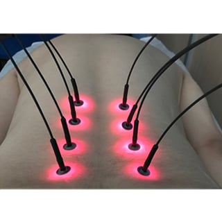 Sistema di Aghi di Luce Light Needle 8 Fibre: Trasforma contemporaneamente 1 laser in 8 punti di uscita