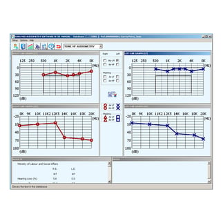 Software Sibelmed W5O per audiometro Sibelmed 400