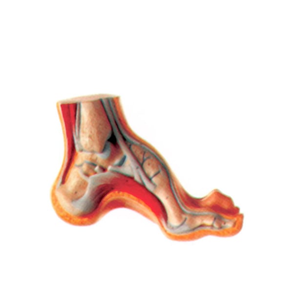 Esposizione del piede cavo