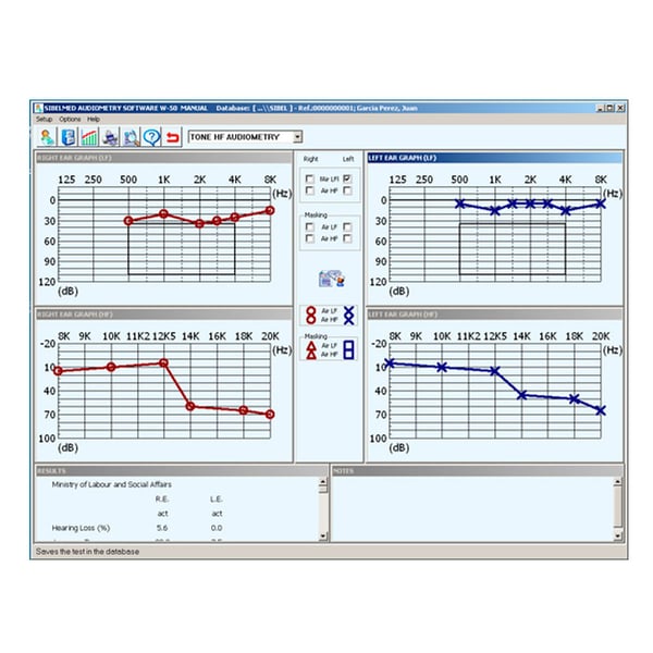 Software Sibelmed W5O per audiometro Sibelmed 400