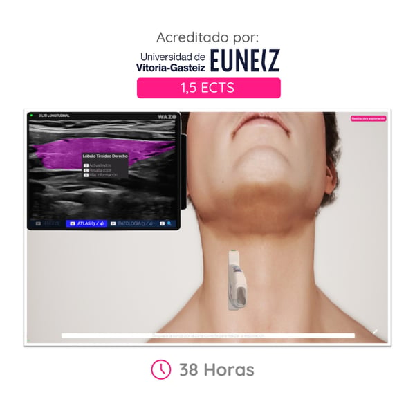 WAZO CAMPUS: Corso online di ecografia cervicale del collo e della tiroide. Attestato universitario ufficiale rilasciato dall'Università di Vitoria-Gasteiz (EUNEIZ).