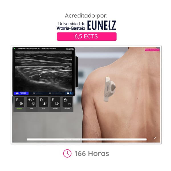 WAZO CAMPUS: Corso online di anatomia muscoloscheletrica. Attestato universitario ufficiale rilasciato dall'Università di Vitoria-Gasteiz (EUNEIZ).