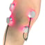 LaserPatch 650: sistema modulare per terapia laser e agopuntura laser LaserPatch 650: sistema modulare per terapia laser e agopuntura laser