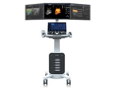 Macchine ad ultrasuoni Chison SonoMax