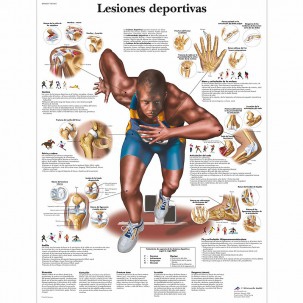 Scheda di anatomia: lesioni sportive