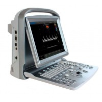 Macchina portatile ad ultrasuoni Chison ECO6