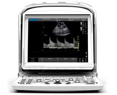 Ecografi Chison ECO Ecografi Chison ECO
