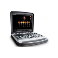 Sistema ecografico portatile Chison Sonobook 8 con scelta di sonde - USATO Sistema ecografico portatile Chison Sonobook 8 con scelta di sonde - USATO