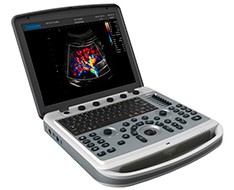 Macchina ad ultrasuoni Chison SonoBook Macchina ad ultrasuoni Chison SonoBook