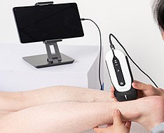 Ecografi Chison Sonoeye Ecografi Chison Sonoeye