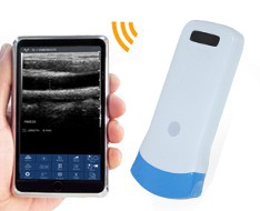 Sonografi SonoStar Sonografi SonoStar