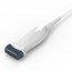 Ecografo Portatile Chison ECO 1 con Sonda Lineare da 5.3-11 MHz: Schermo da 12 pollici in bianco e nero Ecografo Portatile Chison ECO 1 con Sonda Lineare da 5.3-11 MHz: Schermo da 12 pollici in bianco e nero