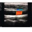 Ultrasuono portatile wireless SonoStar: Color Doppler, sonda lineare da 10 MHz / 128 elementi + iPad regalo! Ultrasuono portatile wireless SonoStar: Color Doppler, sonda lineare da 10 MHz / 128 elementi + iPad regalo!