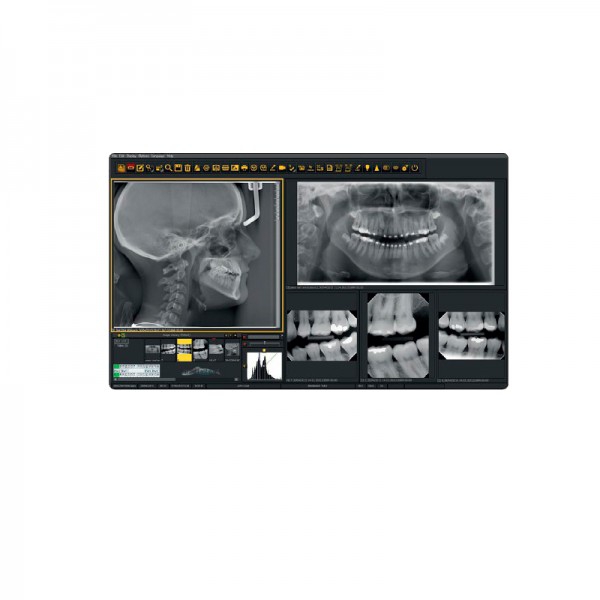Mediadent: Software di Gestione di Immagini Dentali